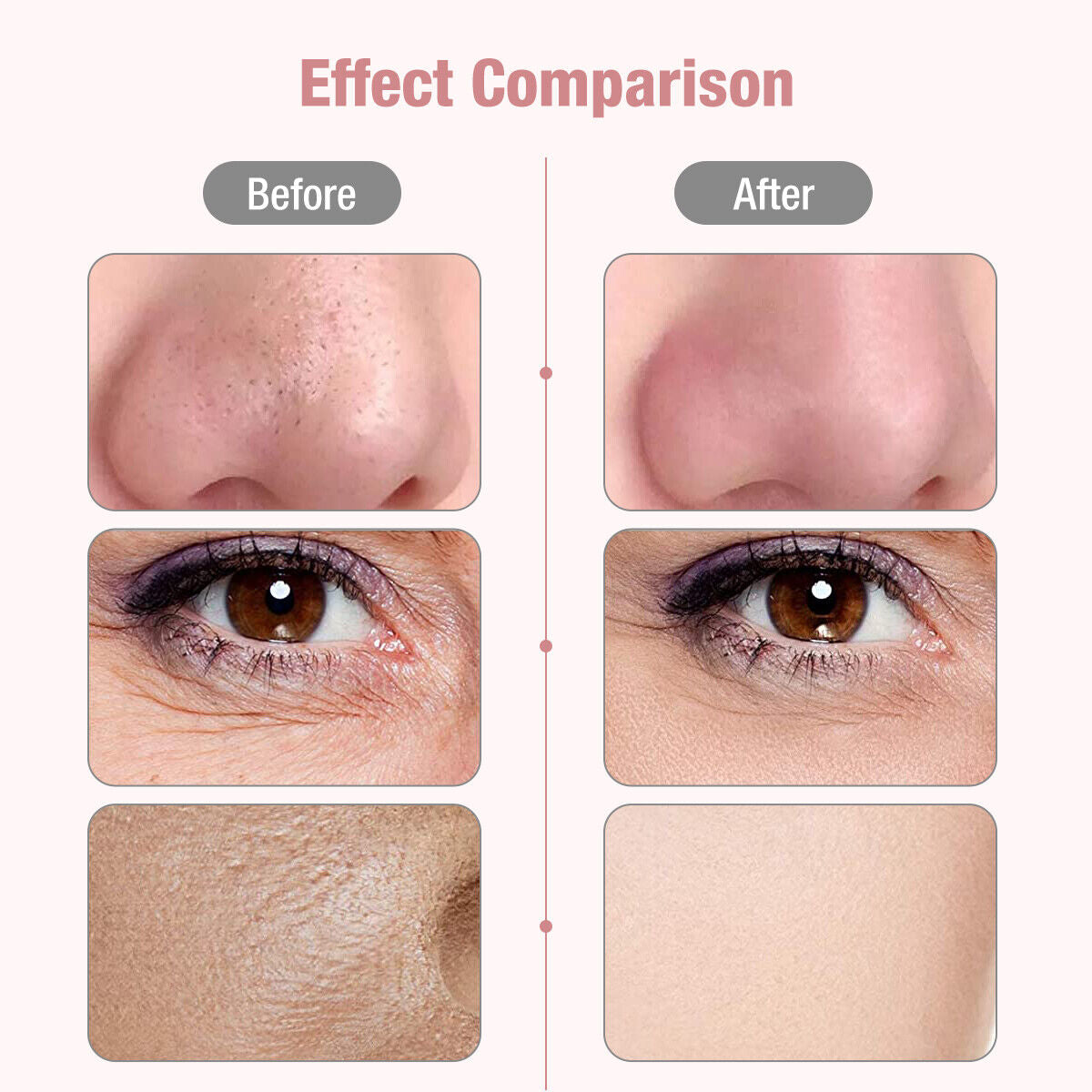 Ultrasonic Skin Scrubber Deep Facial Pore Cleaner - Luxury Look
