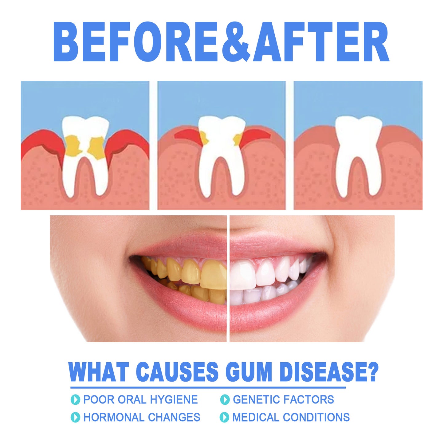 Teeth Repair & Deep Cleaning Gel