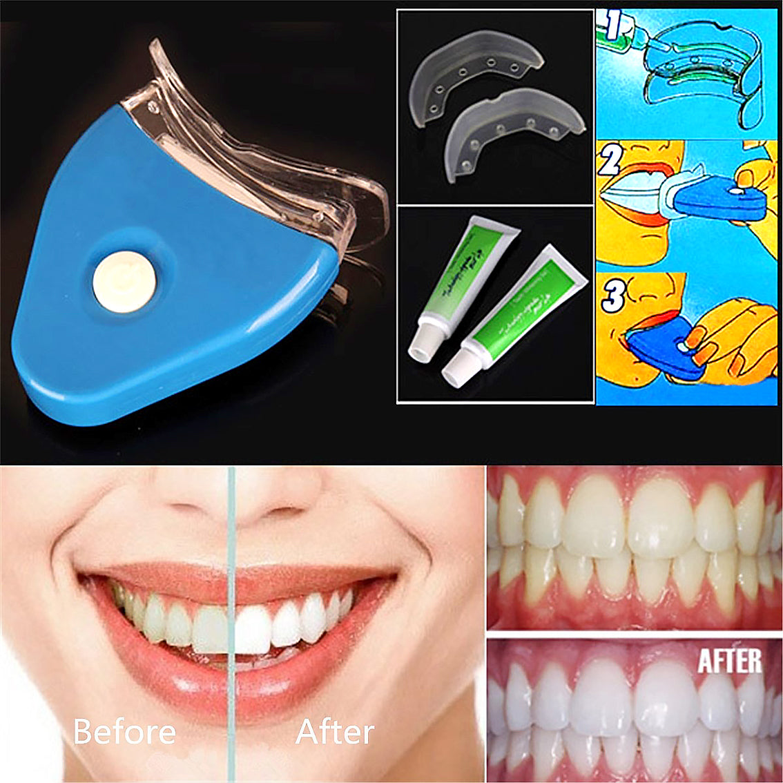 Oral Gel Teeth Whitening Kit - Luxury Look